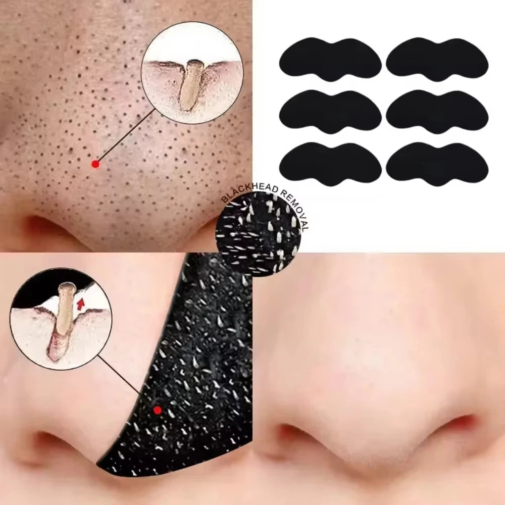 PoreFresh – Deep Cleansing Nose Strips