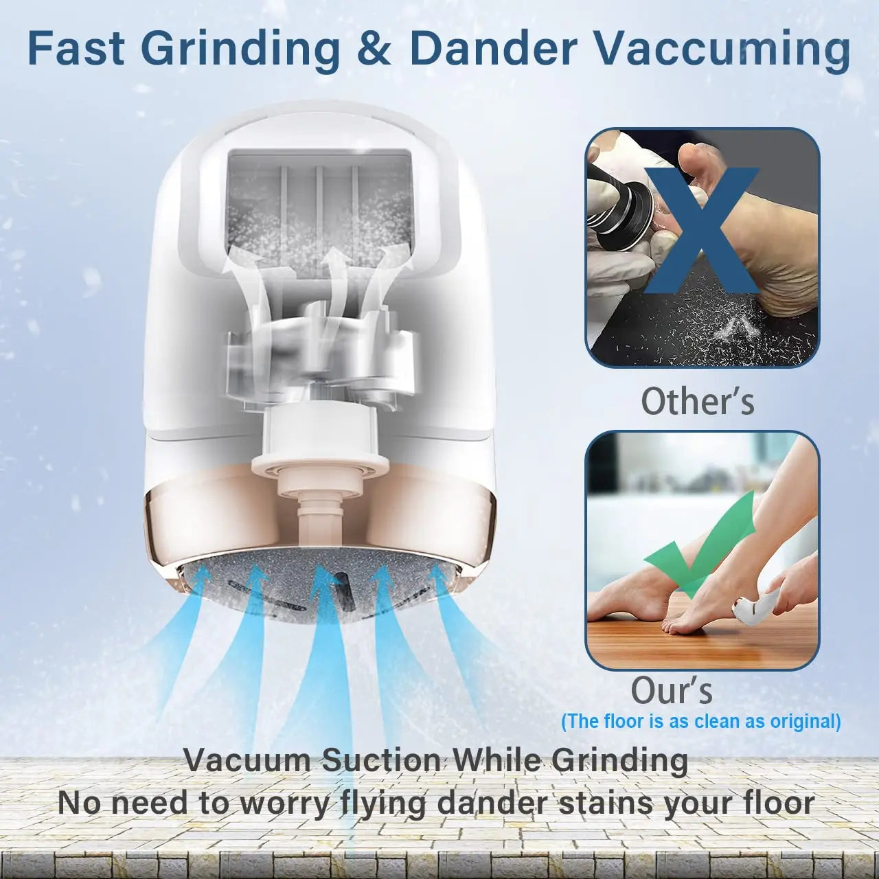 SmoothPro Callus Remover MT-510