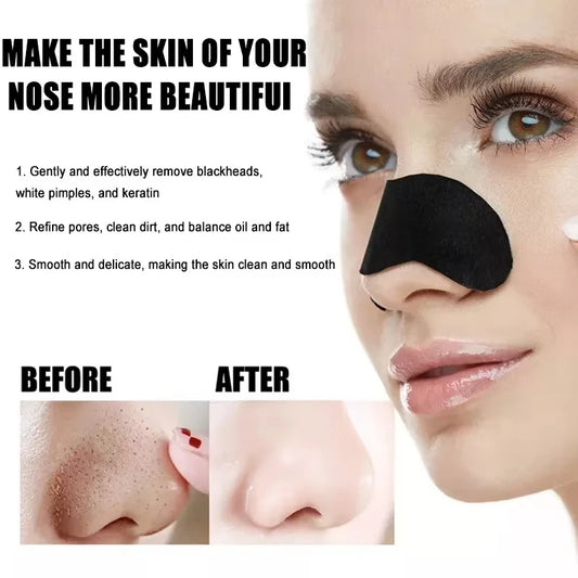 PoreFresh – Deep Cleansing Nose Strips